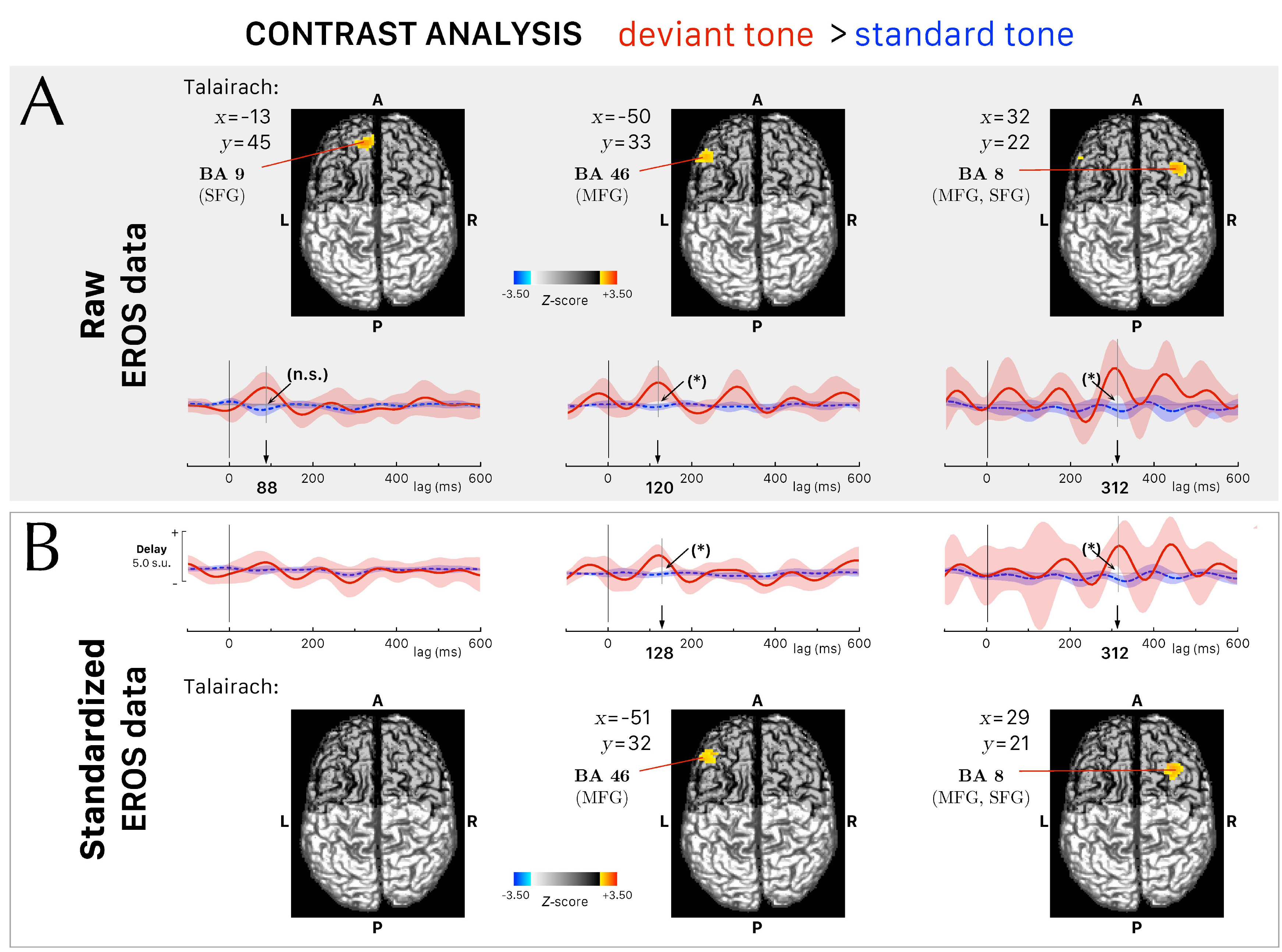 Contrasts of optical EROS responses to deviant versus standard tones, including prefrontal anatomical localization.